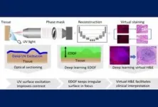 $18M ARPA-H award supports Rice-led research on tumor analysis system for breast, head and neck cancer 2