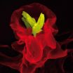 Biosignatures distinguish between tuberculosis and sarcoidosis