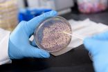 'Bacterial litmus test' provides inexpensive measurement of micronutrients