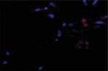 'Fountain of youth' technique rejuvenates aging stem cells