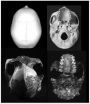 'Homo' is the only primate whose tooth size decreases as its brain size increases