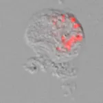 'Pokemonas': Bacteria related to lung parasites discovered, named after Pok&#233;mon