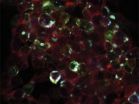 'Radiogenetics' seeks to remotely control cells and genes