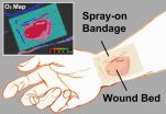 'Smart' bandage emits phosphorescent glow for healing below