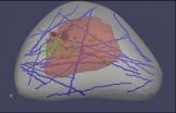 'Virtual breast' could improve cancer detection