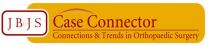 'Watch' cites concern about flexible reamer breakage during anatomic ACL reconstruction