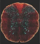 'Zombie cells' hold clues to spinal cord injury repair