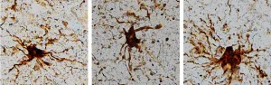 'Zombie' genes? Research shows some genes come to life in the brain after death