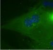 Fasting pathway points the way to new class of diabetes drugs