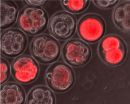 Magical state of embryonic stem cells may help overcome hurdles to therapeutics 