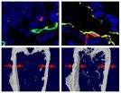 'Unsung' cells double the benefits of a new osteoporosis drug