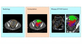 Virtual biopsies could replace tissue biopsies in future thanks to new technique