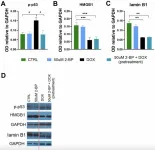 2-bromopalmitate reduces senescence in human cells: Role of palmitoylation