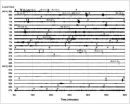 2010 Korea bomb tests probably false alarms, says study  