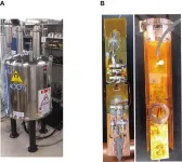 23Na MRI technique unleashes new approach for diagnosing diabetic kidney disease