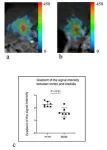 23Na MRI technique unleashes new approach for diagnosing diabetic kidney disease 3