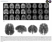 25-year study reveals key factors in healthy brain aging and cognitive performance