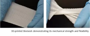 3-D printed Biomesh minimizes hernia repair complications