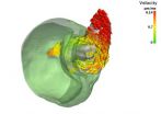 3-D X-ray film: Rapid movements in real time 2