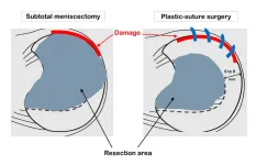 A bright spot in the treatment of lateral disc meniscus injuries in for youth