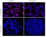 A CNIO study links severe COVID-19 disease to short telomeres