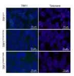 A CNIO team discovers how telomere involvement in tumor generation is regulated