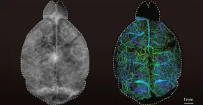 A deep dive into the brain