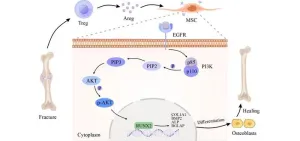 A distinct “repair” role of regulatory T cells in fracture healing