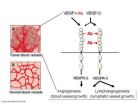 A double block of blood vessels to starve cancerous tumors