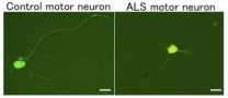 A drug-screening platform for ALS 