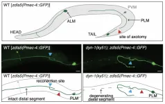 A key protein for repairing broken nerves