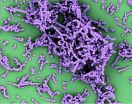 A key step toward a safer strep vaccine