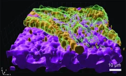 A lung pathogen’s dilemma: infect or resist antibiotics?