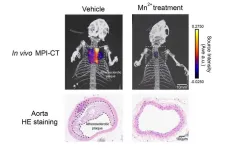 A “manganese bullet” targeting the top killer?