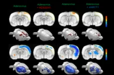 A new breakthrough in Alzheimer disease research - visualizing reactive astrocyte-neuron interaction 2