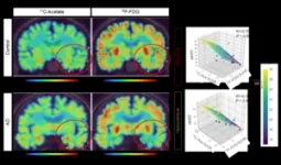 A new breakthrough in Alzheimer disease research - visualizing reactive astrocyte-neuron interaction 3