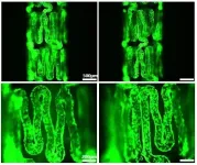 A new concept stent that suppresses adverse effects with cells