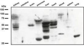 A new way to detect inflammation 2