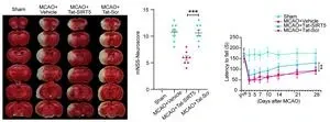 A novel cell-penetrating peptide exerts therapeutic effects against ischemic stroke 2