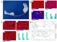 A novel method for controlling the microstructure and performance of 3D printed human implants