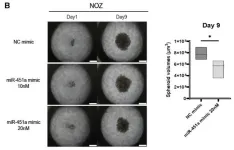 A novel targeted molecular therapy for drug-resistant biliary tract cancer