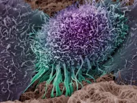 A potential new target for head and neck cancer immunotherapy