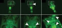 A radar for ADAR: Altered gene tracks RNA editing in neurons