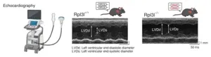 A ribosomal traffic jam that breaks the heart 2