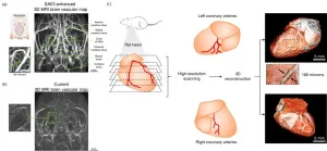 A safer MRI contrast agent for  high-resolution 3D microvascular imaging