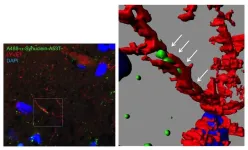 A secret passage for mutant protein to invade the brain