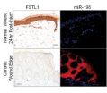 A*STAR scientists discover switch critical to wound healing