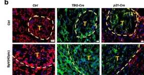 A “ticking time bomb” for liver cancer