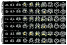 A versatile AI system for analyzing series of medical images