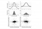 Abnormal involuntary eye movements in amblyopia linked to changes in subcortical regions of brain